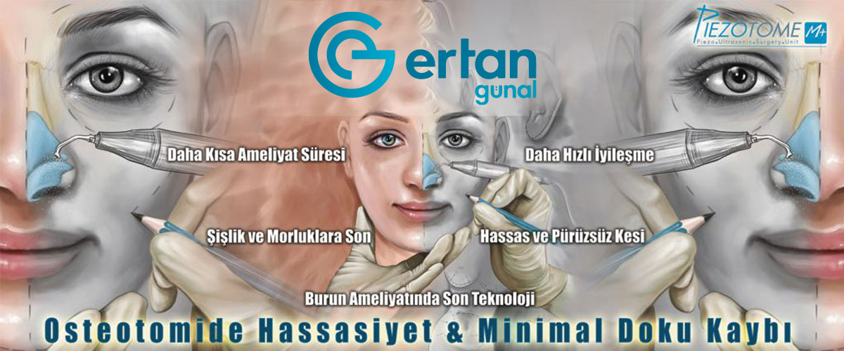 Piezo Burun Estetiği Ertan Günal